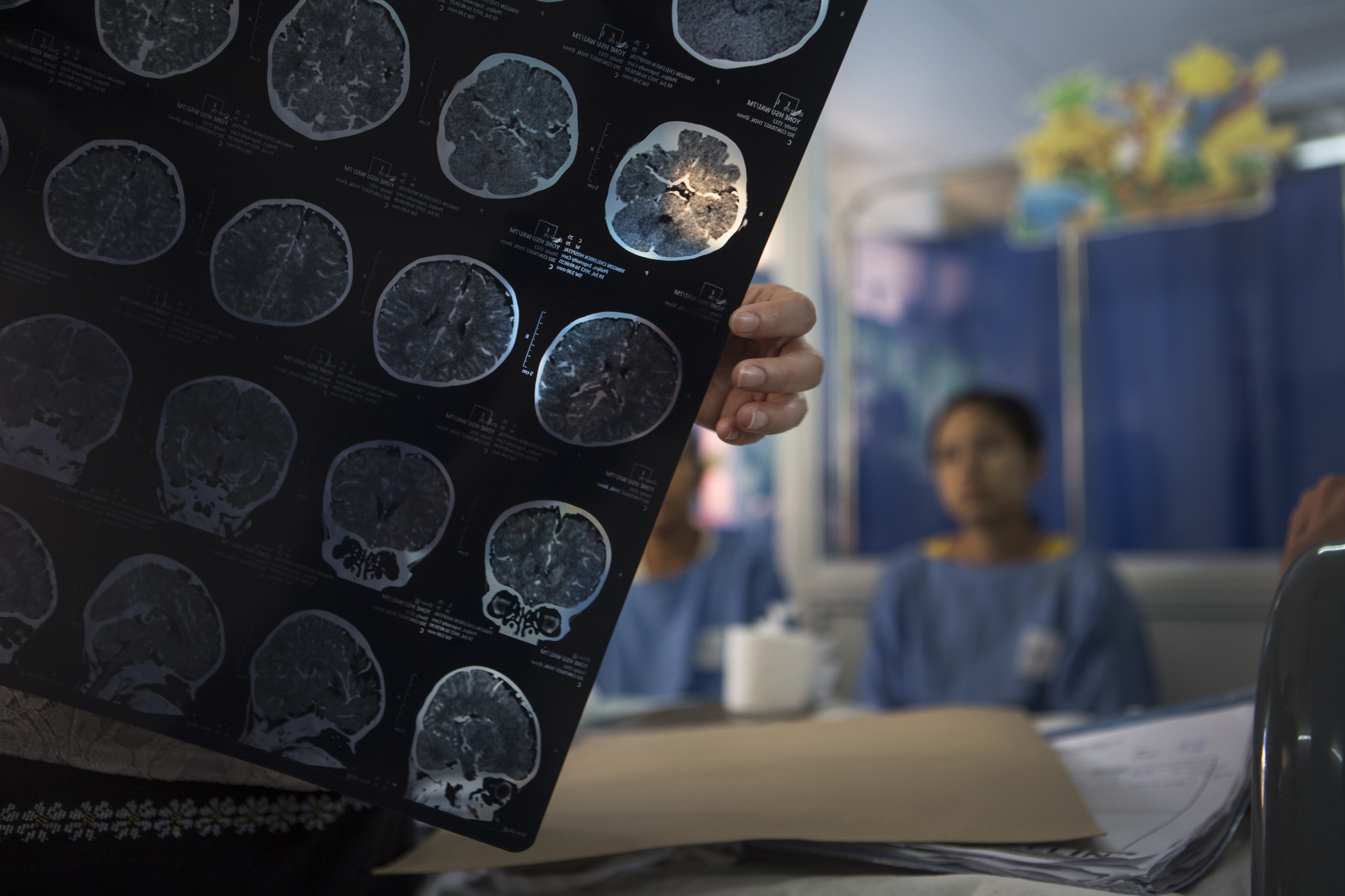 Hôpital Pédiatrique de Yangon, Birmanie - Les médecins analysent les résultats du scanner cérébral d'un jeune patient souffrant d'encéphalite.