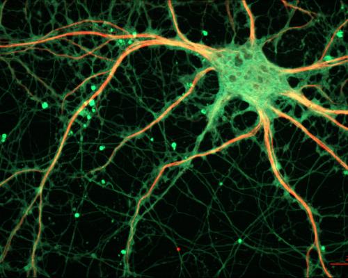 Neuronal diversity: a possible antidote to neurological diseases